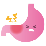 胃の炎症画像
